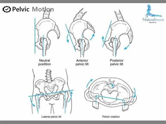 Figura 1: Ilustración de pélvica en neutro y con asimetría (http://blog.naver.com/naturalmove/220534758029)