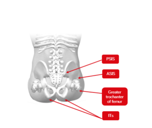 Figura 2. Vista posterior de la pelvis en posición sentada - Rehacademia