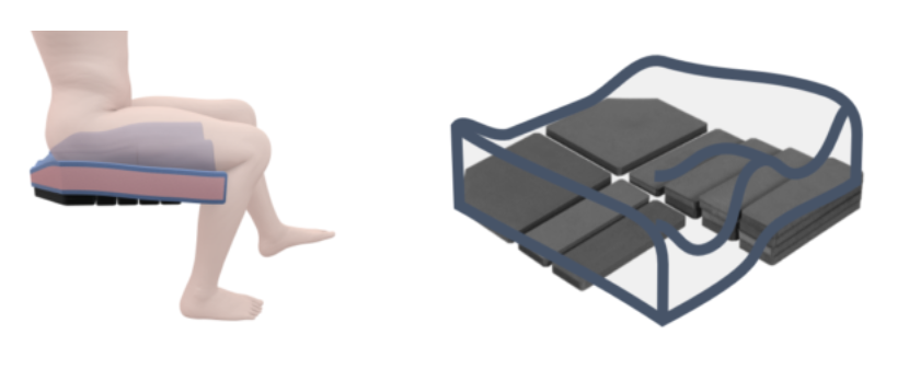 Figura 7. Ejemplo de configuración de cojín clásico Spex para una asimetría leve en la flexión de la cadera - Rehacademia